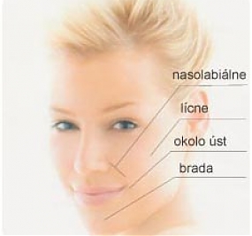 Botox
