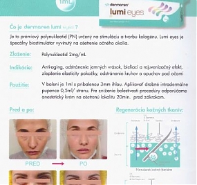 Kolagénová terapia lumi eyes