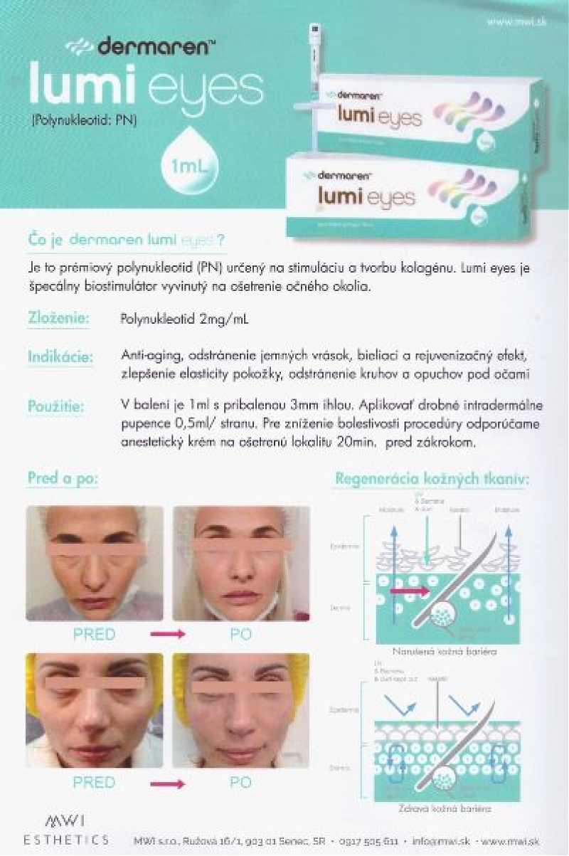 Kolagénová terapia lumi eyes