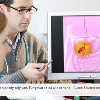 Trápi vás žlčník? Na klinike REVIVE máme špecialistov