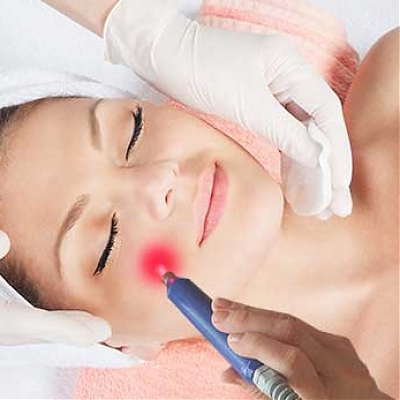 BIOSTIMULAČNÝ LASER