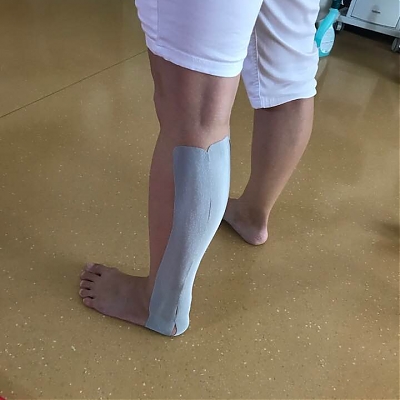 Kinesiotape / Tejpovanie